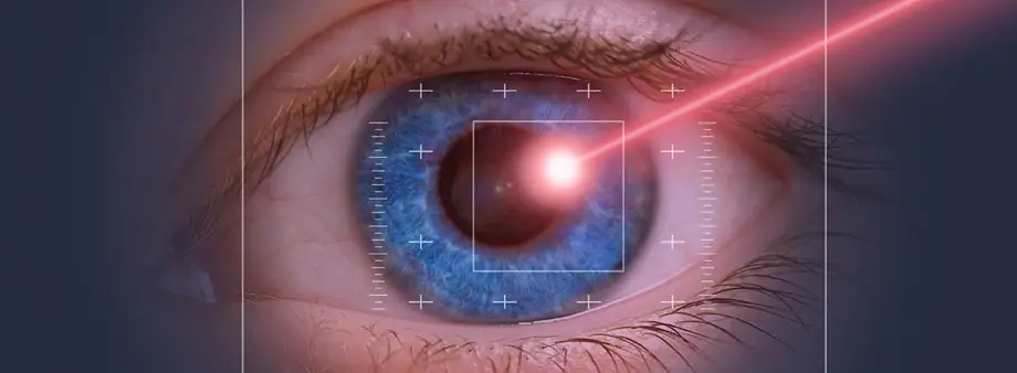 Lasersko skidanje dioptrije - Moje oči – moje pravo da znam