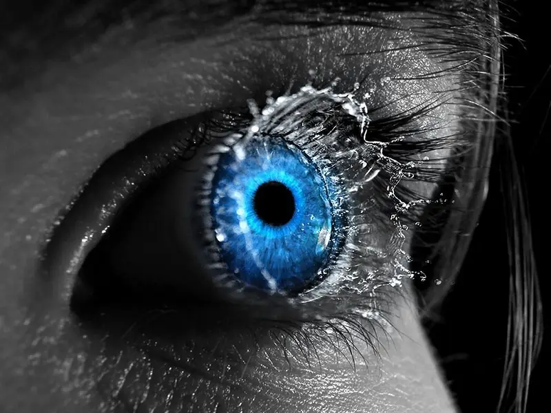 Pojačano suzenje oka Pojačano suzenje oka