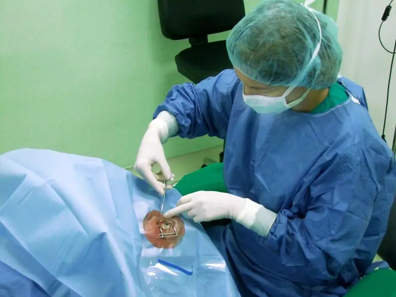 Operacija katarakte - Ugradnja multifokalnih intraokularnih sočiva uz popust od 20% – pametan potez!