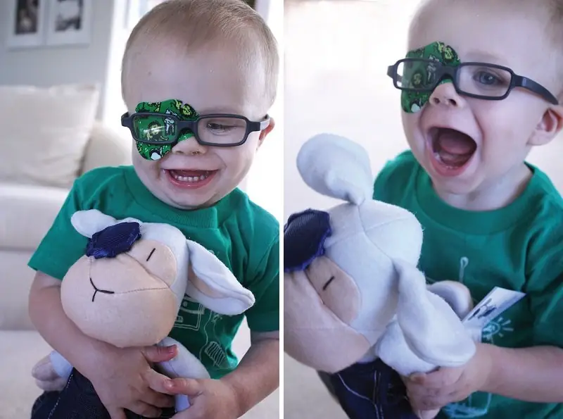 Strabizam kod dece Razrokost kod dece