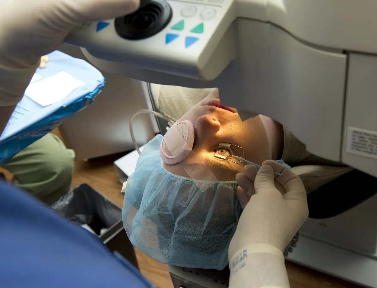 Kako ću se osećati za vreme laserskog skidanja dioptrije?