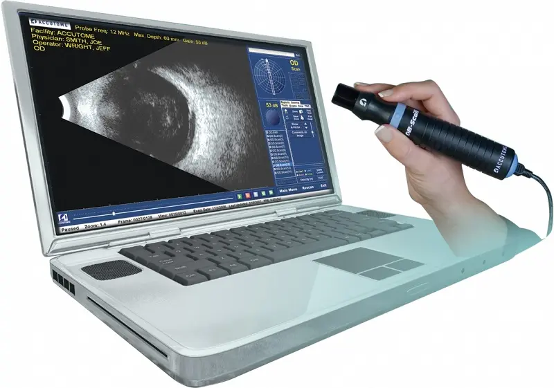 Ultrazvucna-dijagnostika-1