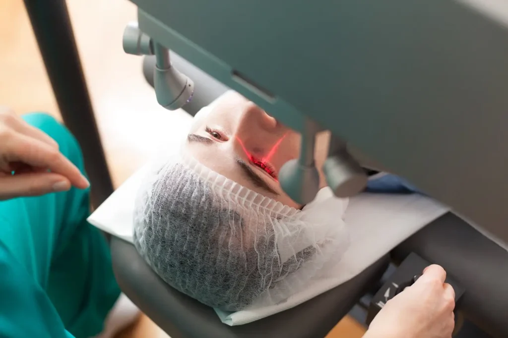 Lasersko skidanje dioptrije